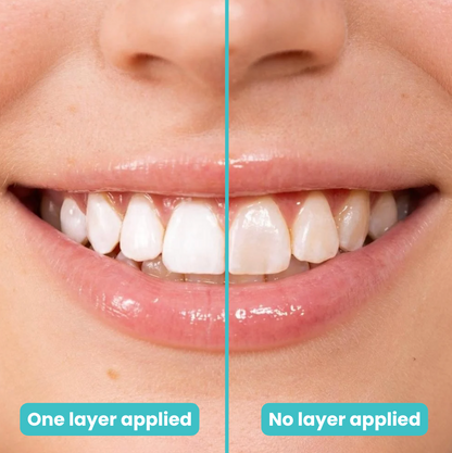 Velora™ Teeth Polish